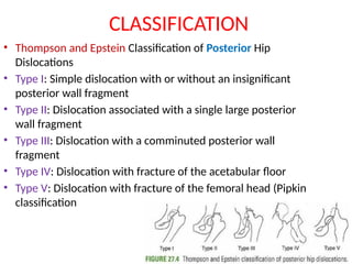 Dislocation of major joints ( Shoulder , hip and knee) | PPTX