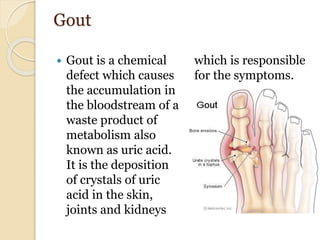 Gout
 Gout is a chemical
defect which causes
the accumulation in
the bloodstream of a
waste product of
metabolism also
known as uric acid.
It is the deposition
of crystals of uric
acid in the skin,
joints and kidneys
which is responsible
for the symptoms.
 