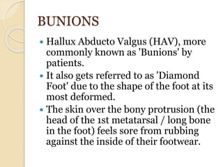 BUNIONS
 Hallux Abducto Valgus (HAV), more
commonly known as 'Bunions' by
patients.
 It also gets referred to as 'Diamond
Foot' due to the shape of the foot at its
most deformed.
 The skin over the bony protrusion (the
head of the 1st metatarsal / long bone
in the foot) feels sore from rubbing
against the inside of their footwear.
 