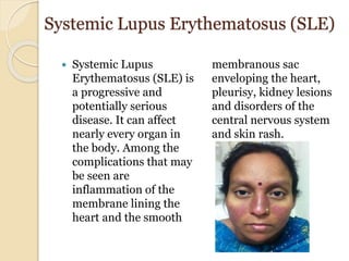 Systemic Lupus Erythematosus (SLE)
 Systemic Lupus
Erythematosus (SLE) is
a progressive and
potentially serious
disease. It can affect
nearly every organ in
the body. Among the
complications that may
be seen are
inflammation of the
membrane lining the
heart and the smooth
membranous sac
enveloping the heart,
pleurisy, kidney lesions
and disorders of the
central nervous system
and skin rash.
 