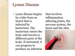Lymes Disease
 Lyme disease begins
by a bite from an
insect that is
infected by
bacterium. The
bacterium enters the
body and travels to
different parts of the
body. If untreated, it
can progress to
produce an infection
that involves
inflammation
affecting joints, the
nervous system, the
heart and the skin.
 