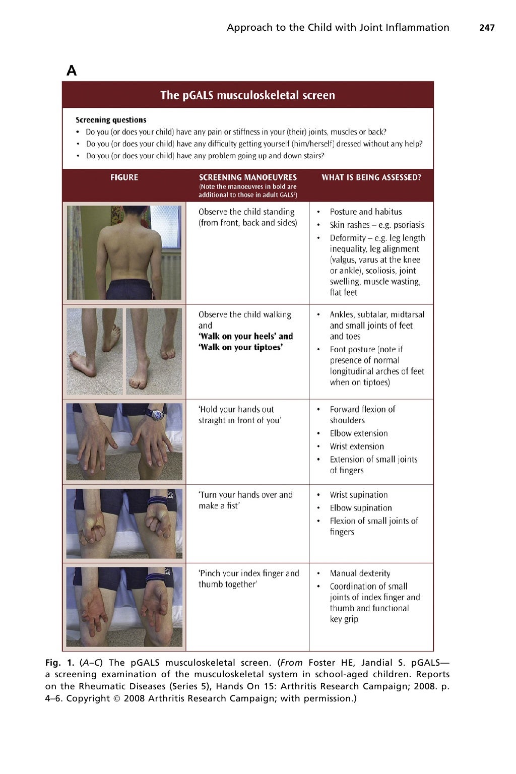 Approach to Arthritis in Children