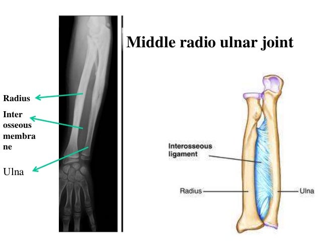 joint simple description with