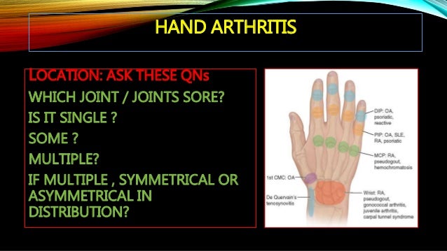 Joint pain DR.RISHIKESAN K.V