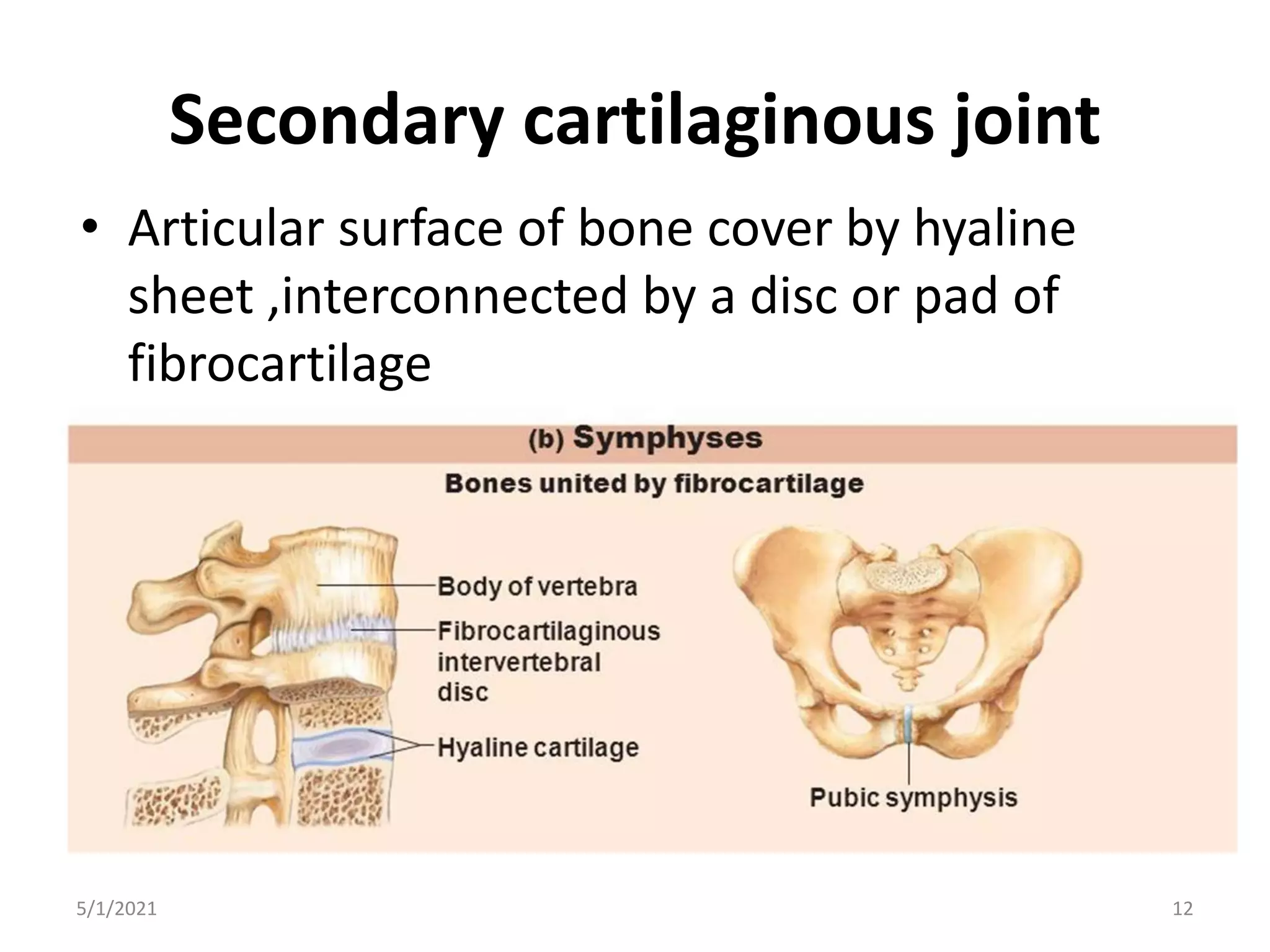 Secondary cartilaginous joint
• Articular surface of bone cover by hyaline
sheet ,interconnected by a disc or pad of
fibrocartilage
5/1/2021 12
 