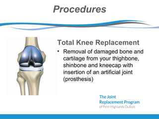 Procedures
Total Knee Replacement
• Removal of damaged bone and
cartilage from your thighbone,
shinbone and kneecap with
insertion of an artificial joint
(prosthesis)
 