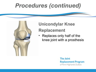 Procedures (continued)
Unicondylar Knee
Replacement
• Replaces only half of the
knee joint with a prosthesis
 