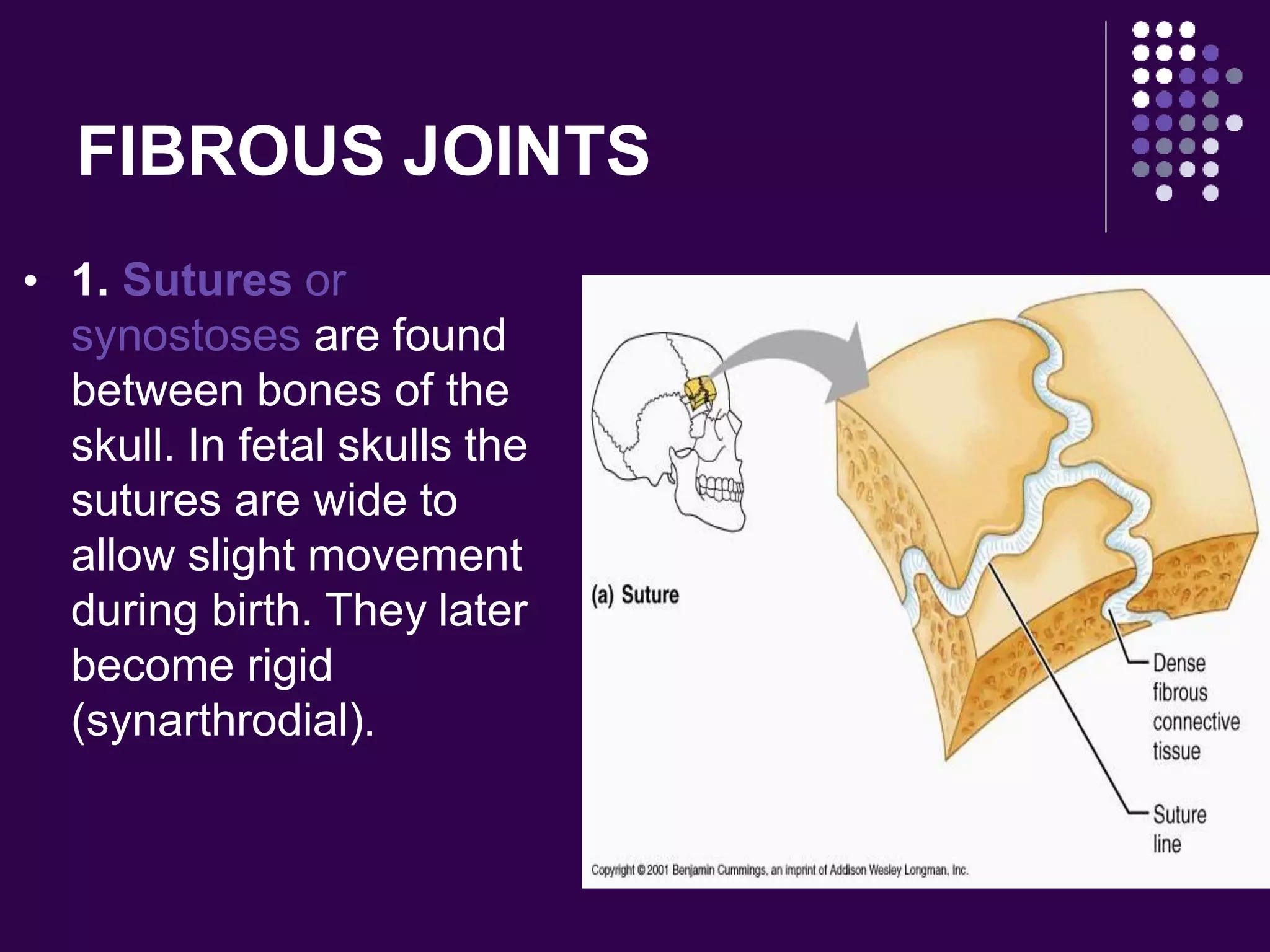 FIBROUS JOINTS
 1. Sutures or
synostoses are found
between bones of the
skull. In fetal skulls the
sutures are wide to
allow slight movement
during birth. They later
become rigid
(synarthrodial).
 