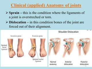 Clinical (applied) Anatomy of joints
 Sprain – this is the condition where the ligaments of
a joint is overstreched or torn.
 Dislocation – in this condition bones of the joint are
forced out of their alignment.
31
 