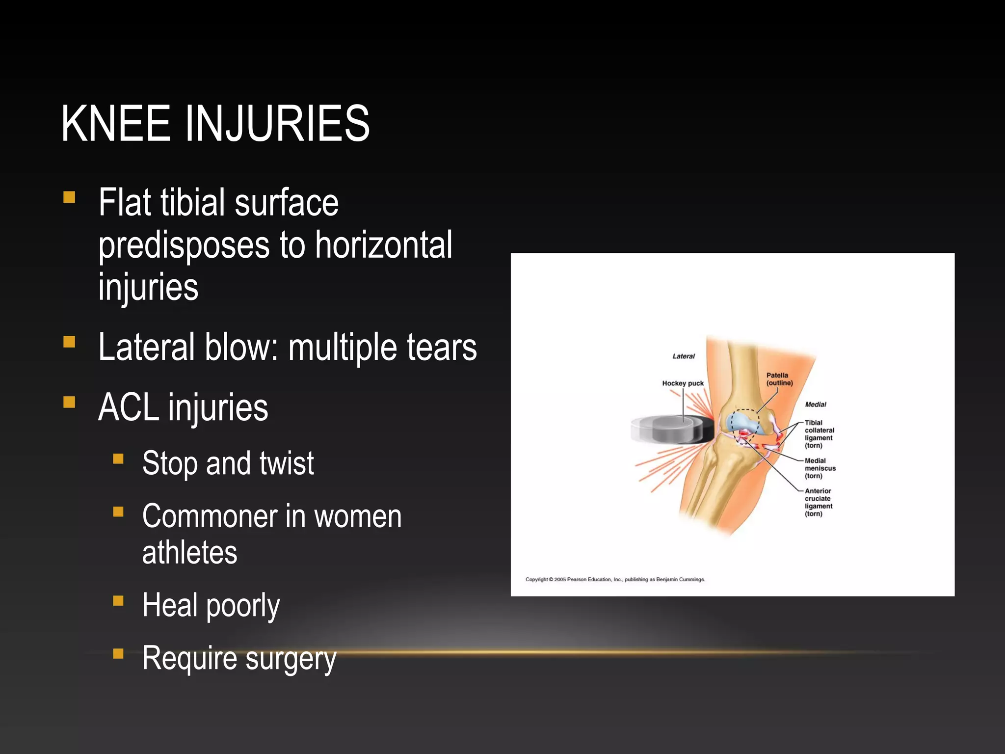 KNEE INJURIES
 Flat tibial surface
predisposes to horizontal
injuries
 Lateral blow: multiple tears
 ACL injuries
 Stop and twist
 Commoner in women
athletes
 Heal poorly
 Require surgery
 