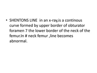 • SHENTONS LINE in an x-ray,is a continous
curve formed by upper border of obturator
foramen 7 the lower border of the neck of the
femur.In # neck femur ,line becomes
abnormal.
 
