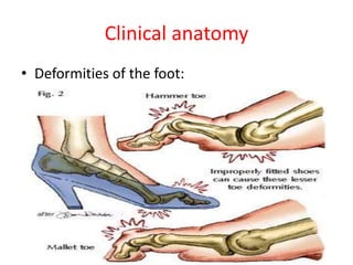 Clinical anatomy
• Deformities of the foot:
 