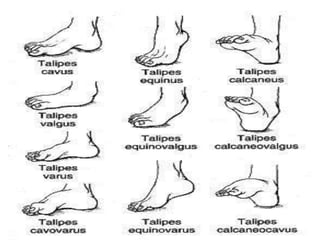 Joints of lower limb