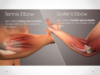 Joints of upper limb 