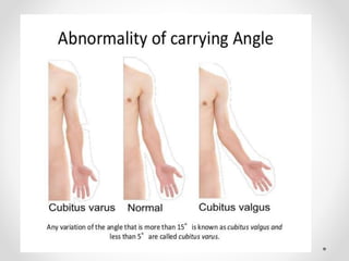 Joints of upper limb 