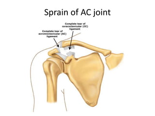 Joints of upper limb | PPT