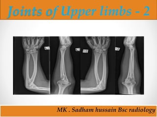 MK . Sadham hussain Bsc radiology
Joints of Upper limbs - 2
 