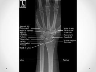 Joints of upper limbs 