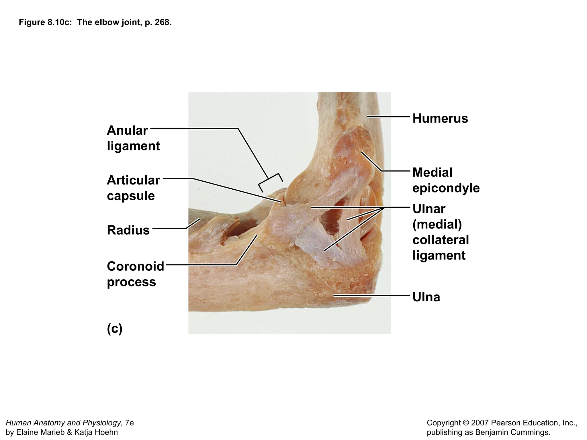 Figure 8.10c:  The elbow joint, p. 268. (c) Anular ligament Humerus Medial epicondyle Ulnar (medial) collateral ligament Ulna Articular capsule Radius Coronoid process 