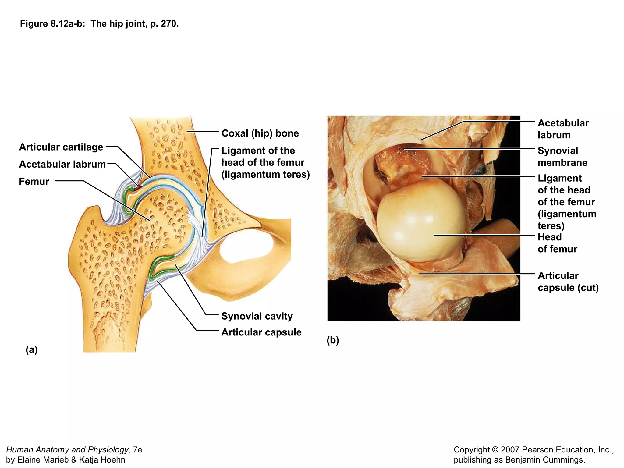 Figure 8.12a-b:  The hip joint, p. 270. (a) (b) Articular cartilage Coxal (hip) bone Ligament of the head of the femur (ligamentum teres) Synovial cavity Articular capsule Acetabular labrum Femur Acetabular labrum Synovial membrane Ligament of the head of the femur (ligamentum teres) Head of femur Articular capsule (cut) 