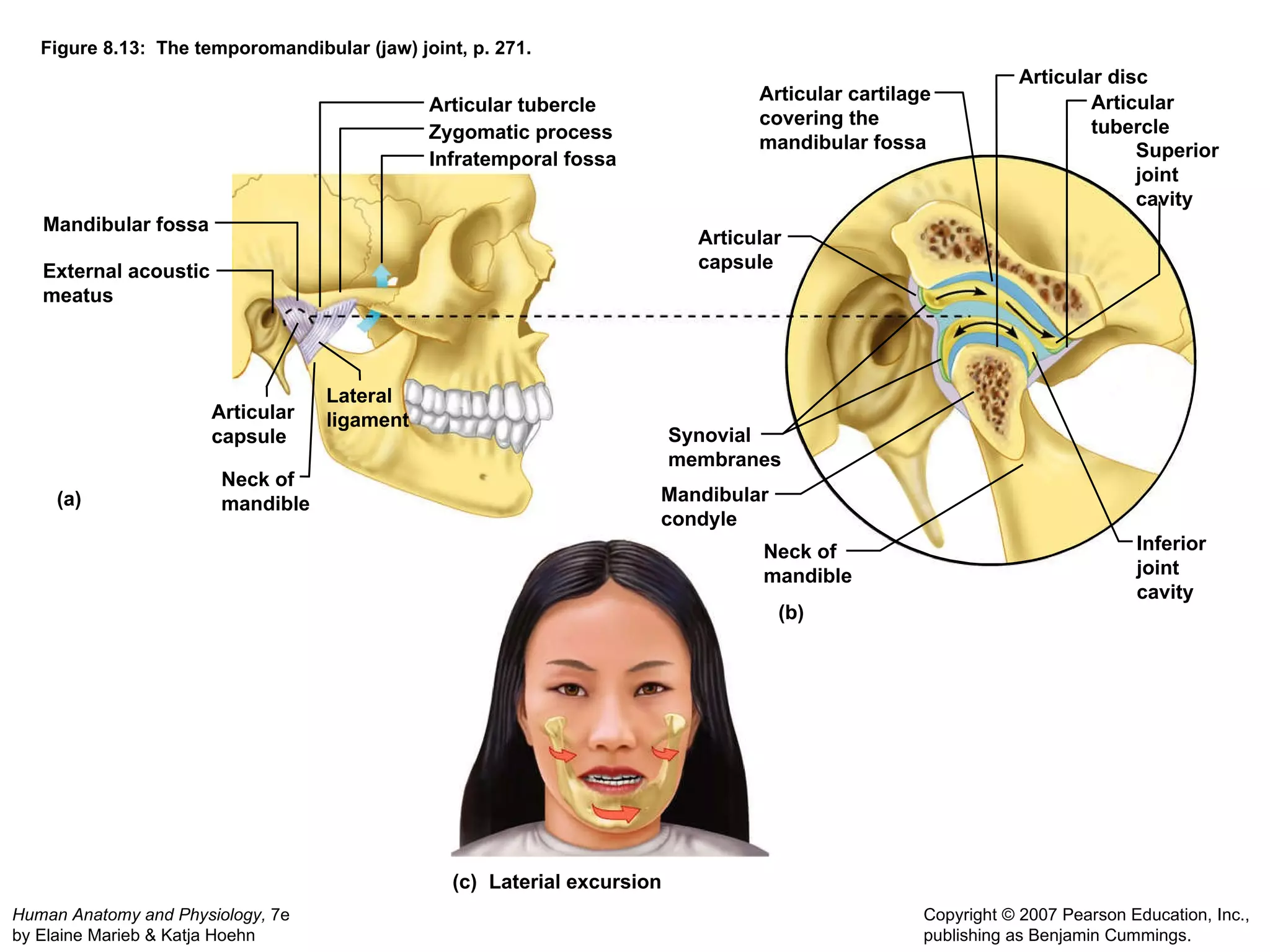 Figure 8.13:  The temporomandibular (jaw) joint, p. 271. (a) (b) (c) Zygomatic process Mandibular fossa Articular tubercle Infratemporal fossa External acoustic meatus Lateral  ligament Articular capsule Neck of  mandible Articular capsule Articular cartilage  covering the  mandibular fossa Articular disc Articular tubercle Superior joint cavity Inferior joint cavity Mandibular condyle Neck of  mandible Synovial membranes Laterial excursion 