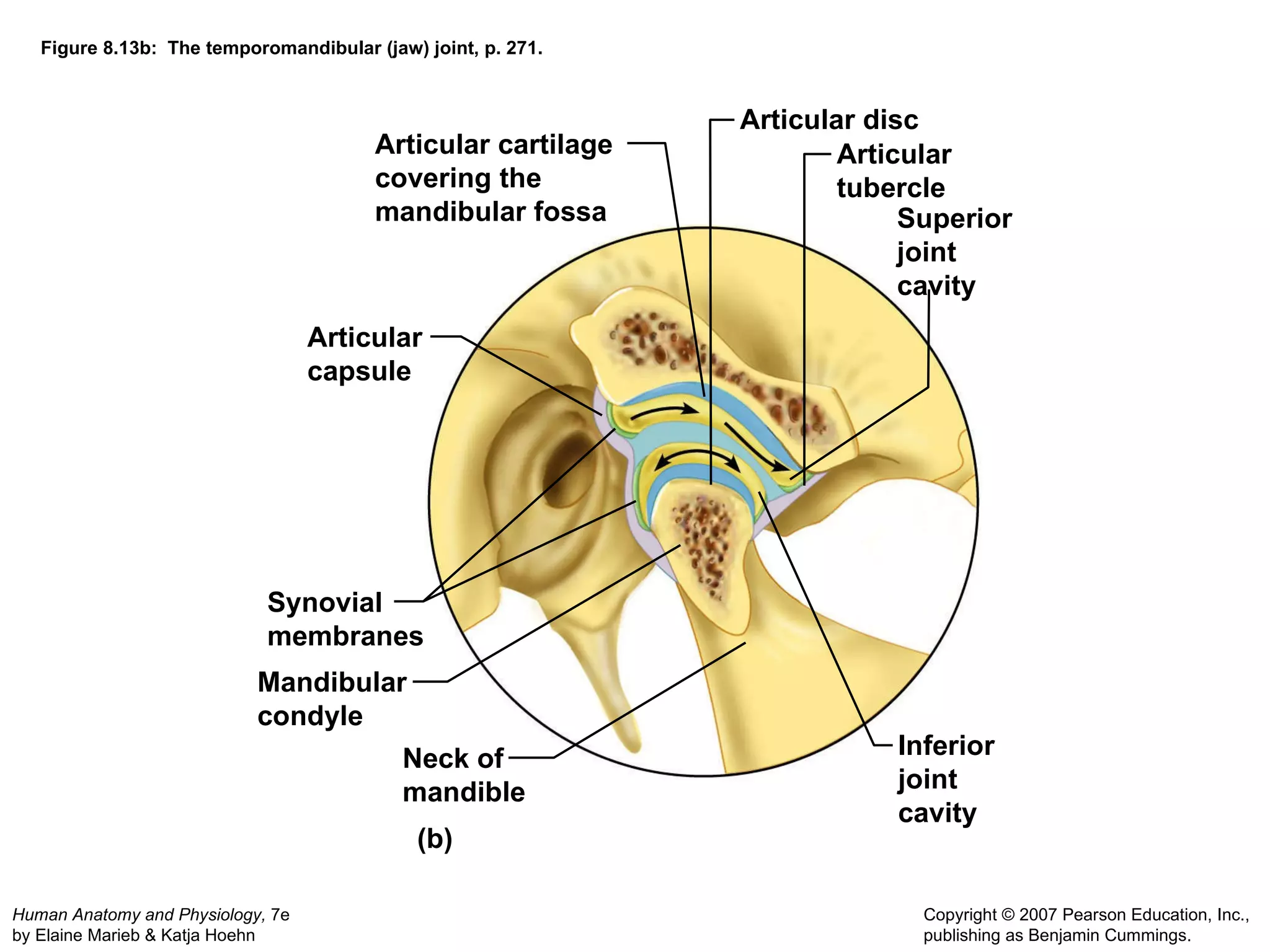 Figure 8.13b:  The temporomandibular (jaw) joint, p. 271. (b) Articular capsule Articular cartilage  covering the  mandibular fossa Articular disc Articular tubercle Superior joint cavity Inferior joint cavity Mandibular condyle Neck of  mandible Synovial membranes 
