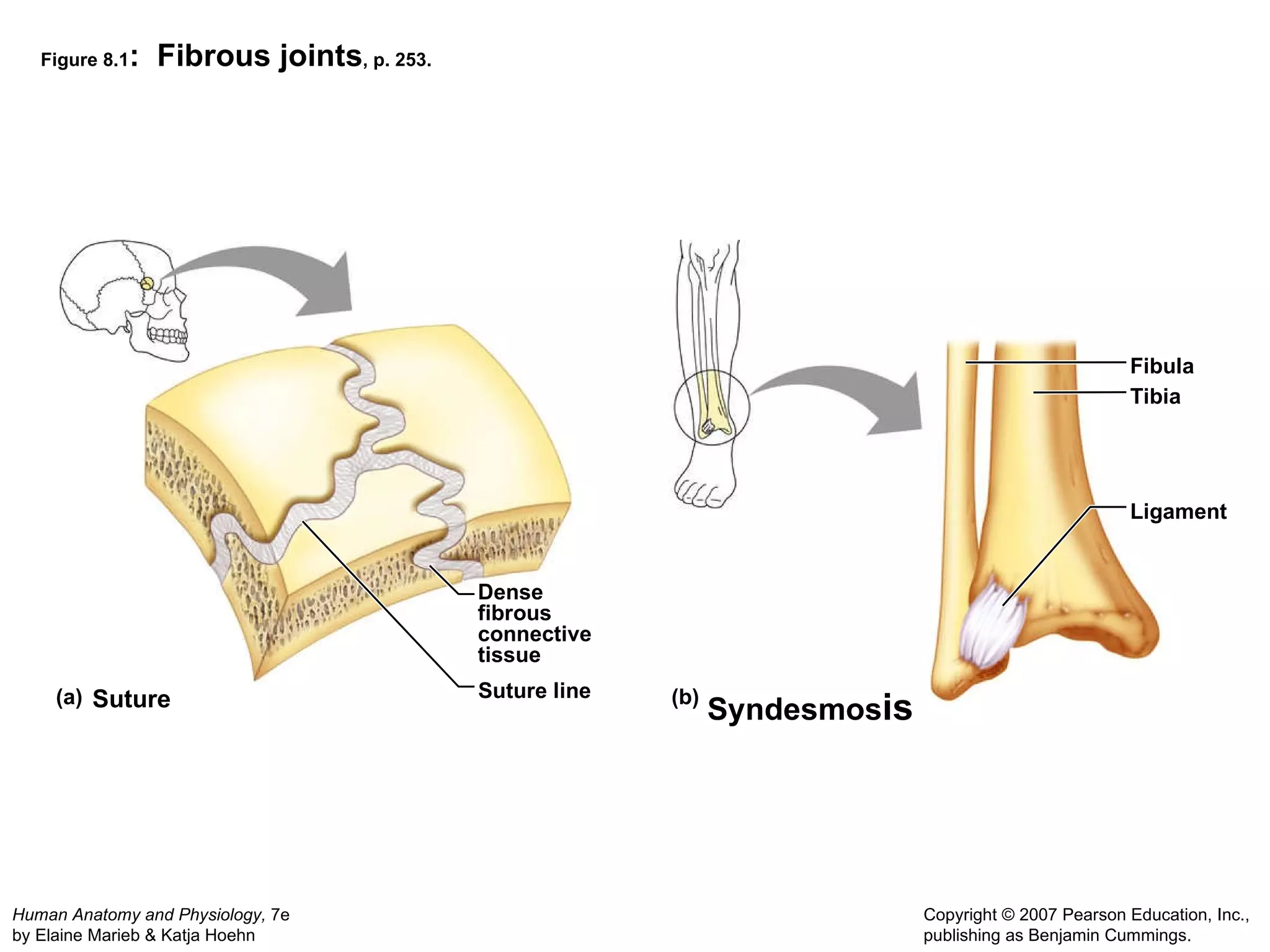 Figure 8.1 :  Fibrous joints , p. 253. (a) (b) Dense fibrous connective tissue Suture line Fibula Tibia Suture Syndesmos is Ligament 