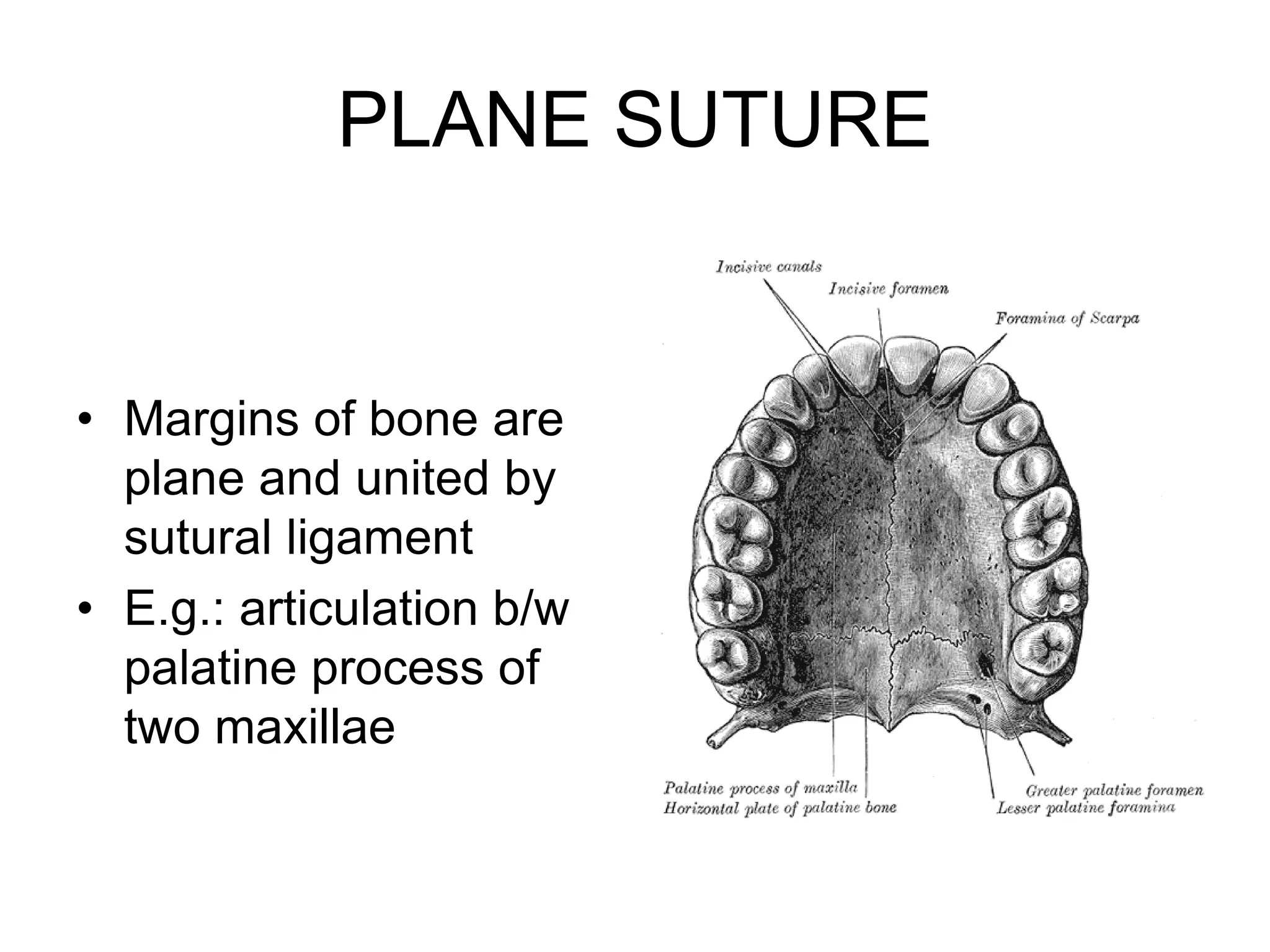 PLANE SUTURE
• Margins of bone are
plane and united by
sutural ligament
• E.g.: articulation b/w
palatine process of
two maxillae
 