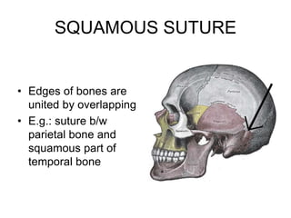 SQUAMOUS SUTURE
• Edges of bones are
united by overlapping
• E.g.: suture b/w
parietal bone and
squamous part of
temporal bone
 