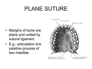 PLANE SUTURE
• Margins of bone are
plane and united by
sutural ligament
• E.g.: articulation b/w
palatine process of
two maxillae
 