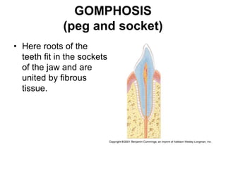GOMPHOSIS
(peg and socket)
• Here roots of the
teeth fit in the sockets
of the jaw and are
united by fibrous
tissue.
 