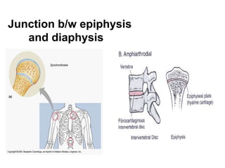 Junction b/w epiphysis
and diaphysis
 