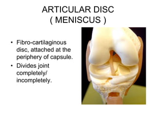 ARTICULAR DISC
( MENISCUS )
• Fibro-cartilaginous
disc, attached at the
periphery of capsule.
• Divides joint
completely/
incompletely.
 