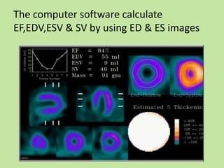 Nuclear imaging in cardiology | PPTX