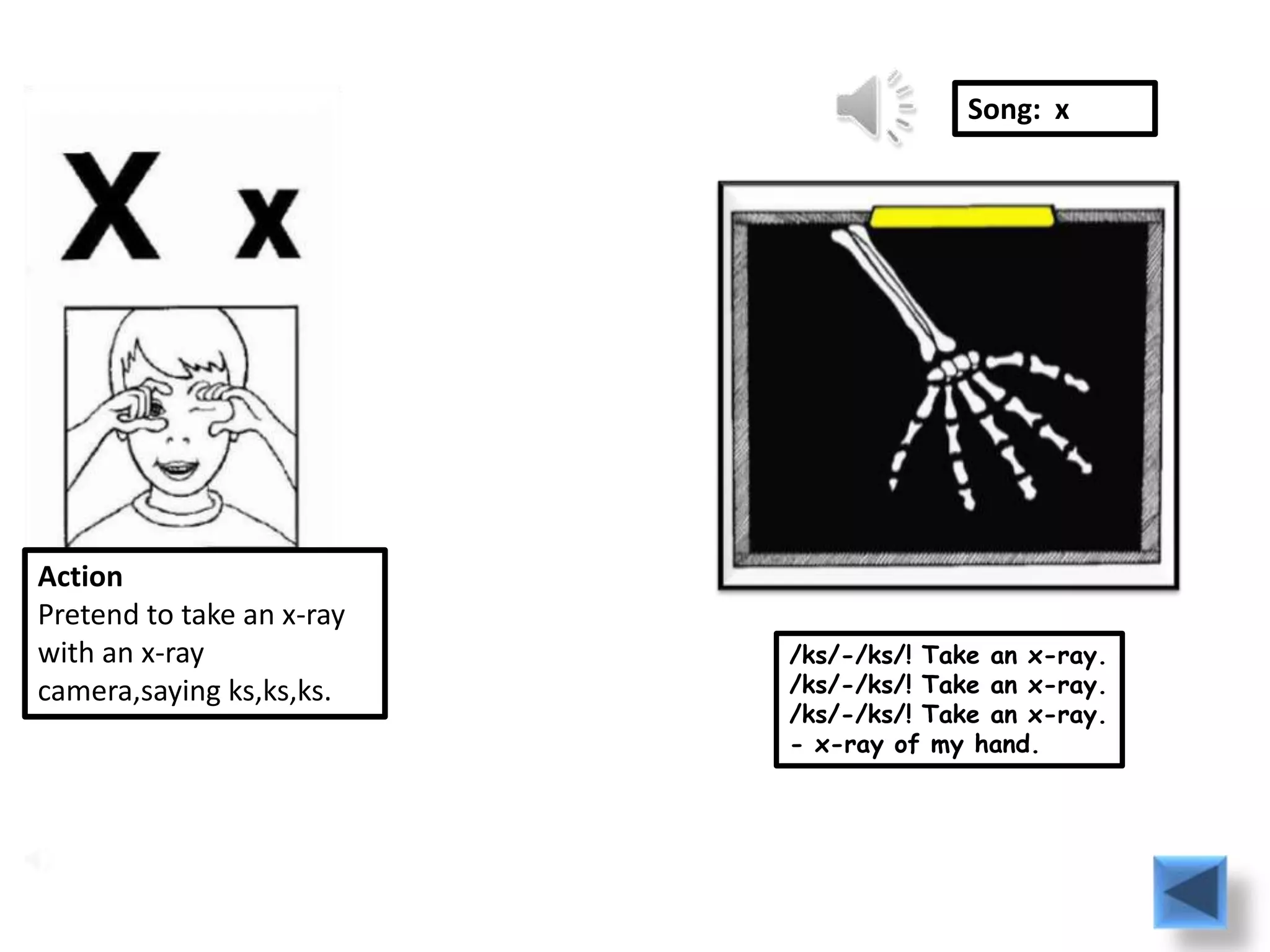 Song: x




Action
Pretend to take an x-ray
with an x-ray              /ks/-/ks/! Take an x-ray.
camera,saying ks,ks,ks.    /ks/-/ks/! Take an x-ray.
                           /ks/-/ks/! Take an x-ray.
                           - x-ray of my hand.
 