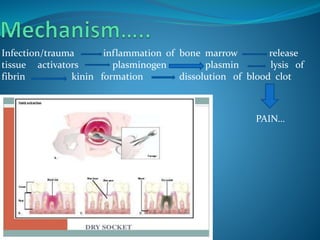 Infection/trauma inflammation of bone marrow release
tissue activators plasminogen plasmin lysis of
fibrin kinin formation dissolution of blood clot
PAIN…
 