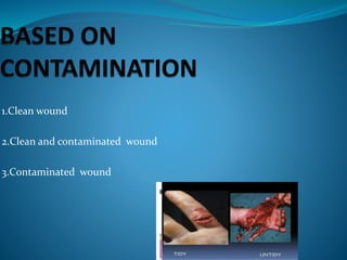 1.Clean wound
2.Clean and contaminated wound
3.Contaminated wound
 