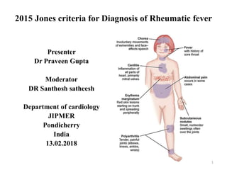 2015 Jones criteria for Diagnosis of Rheumatic fever
Presenter
Dr Praveen Gupta
Moderator
DR Santhosh satheesh
Department of cardiology
JIPMER
Pondicherry
India
13.02.2018
1
 