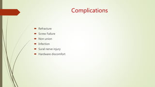 Complications
 Refracture
 Screw Failure
 Non union
 Infection
 Sural nerve injury
 Hardware discomfort
 