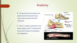 Anatomy
 The peroneus brevis tendon and
lateral band of the plantar fascia
insert onto the base of the fifth
metatarsal.
 There is a relative watershed in the
blood supply to the 5th metaTarsal at
the junction between the diaphysis
and metaphysis.
 