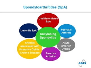Spondyloarthropathies - Dr Jon Packham | PPTX