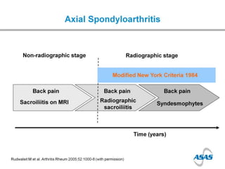 Spondyloarthropathies - Dr Jon Packham | PPTX