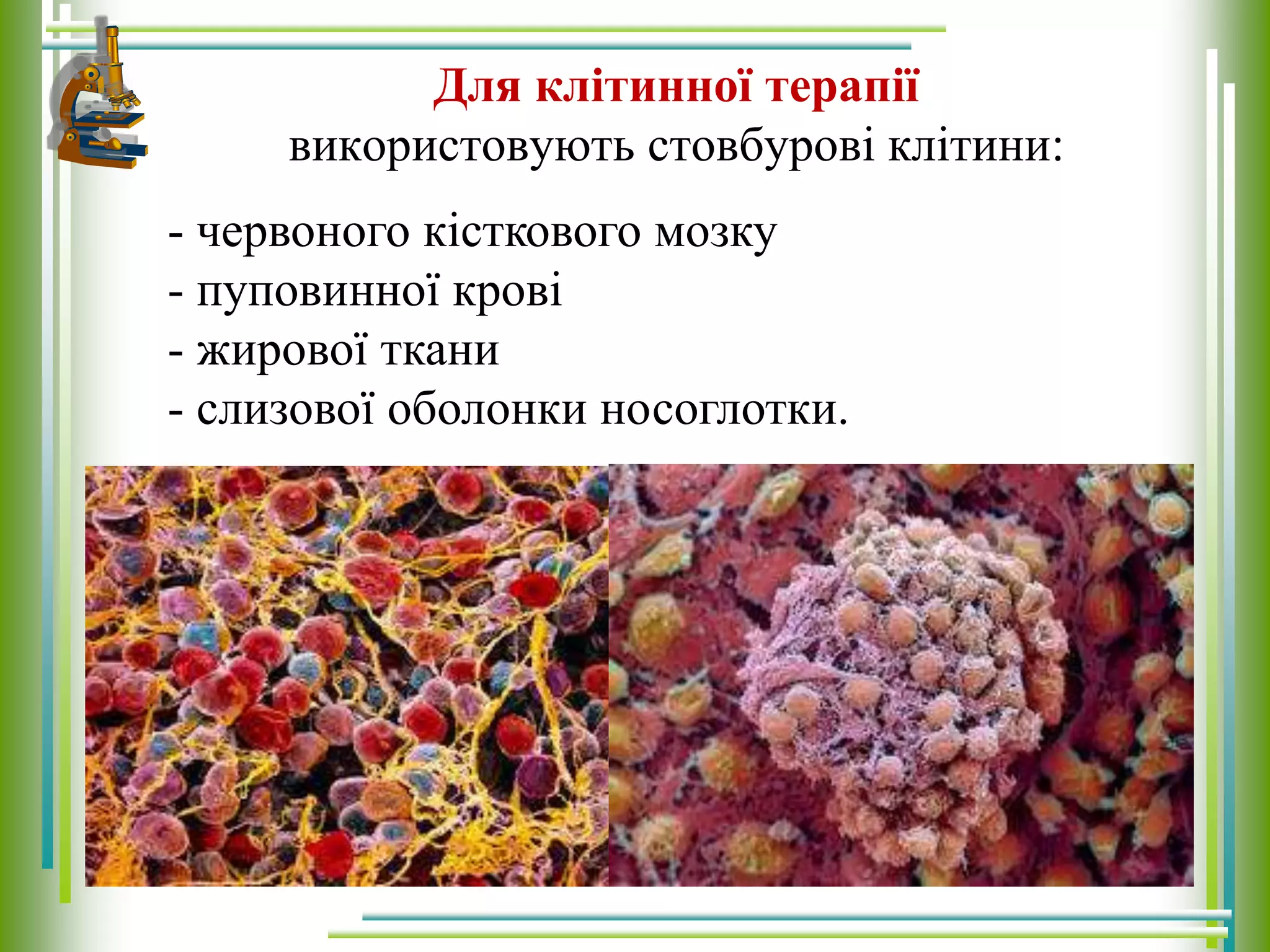 Для клітинної терапії
використовують стовбурові клітини:
- червоного кісткового мозку
- пуповинної крові
- жирової ткани
- слизової оболонки носоглотки.
 