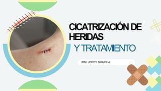 CICATRIZACIÓNDE
HERIDAS
YTRATAMIENTO
IRM. JORDY GUAICHA
 