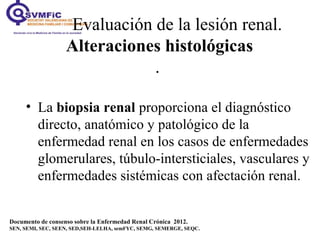 Documento de consenso sobre la Enfermedad Renal Crónica 2012.
SEN, SEMI, SEC, SEEN, SED,SEH-LELHA, semFYC, SEMG, SEMERGE, SEQC.
• La biopsia renal proporciona el diagnóstico
directo, anatómico y patológico de la
enfermedad renal en los casos de enfermedades
glomerulares, túbulo-intersticiales, vasculares y
enfermedades sistémicas con afectación renal.
Evaluación de la lesión renal.
Alteraciones histológicas
.
 
