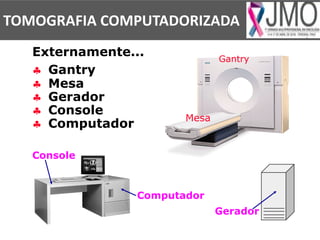 § Gantry
§ Mesa
§ Gerador
§ Console
§ Computador
Externamente...
Mesa
Gantry
Console
Computador
Gerador
TOMOGRAFIA COMPUTADORIZADA
 