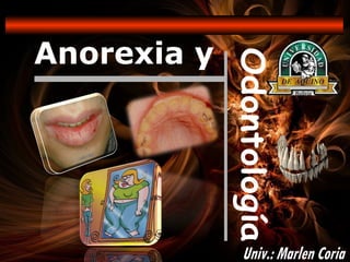 Anorexia y Odontología Univ.: Marlen Coria 