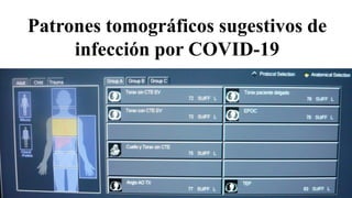 Patrones tomográficos sugestivos de
infección por COVID-19
 