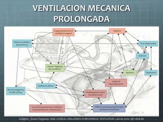 Goligher , Ewan; Ferguson, Niall. CLINICAL CHALLENGES IN MECHANICAL VENTILATION. Lancet 2016; 387:1856-66
VENTILACION MECANICA
PROLONGADA
 