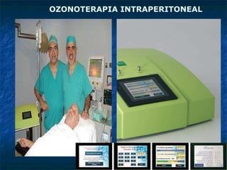OZONOTERAPIA INTRAPERITONEAL 